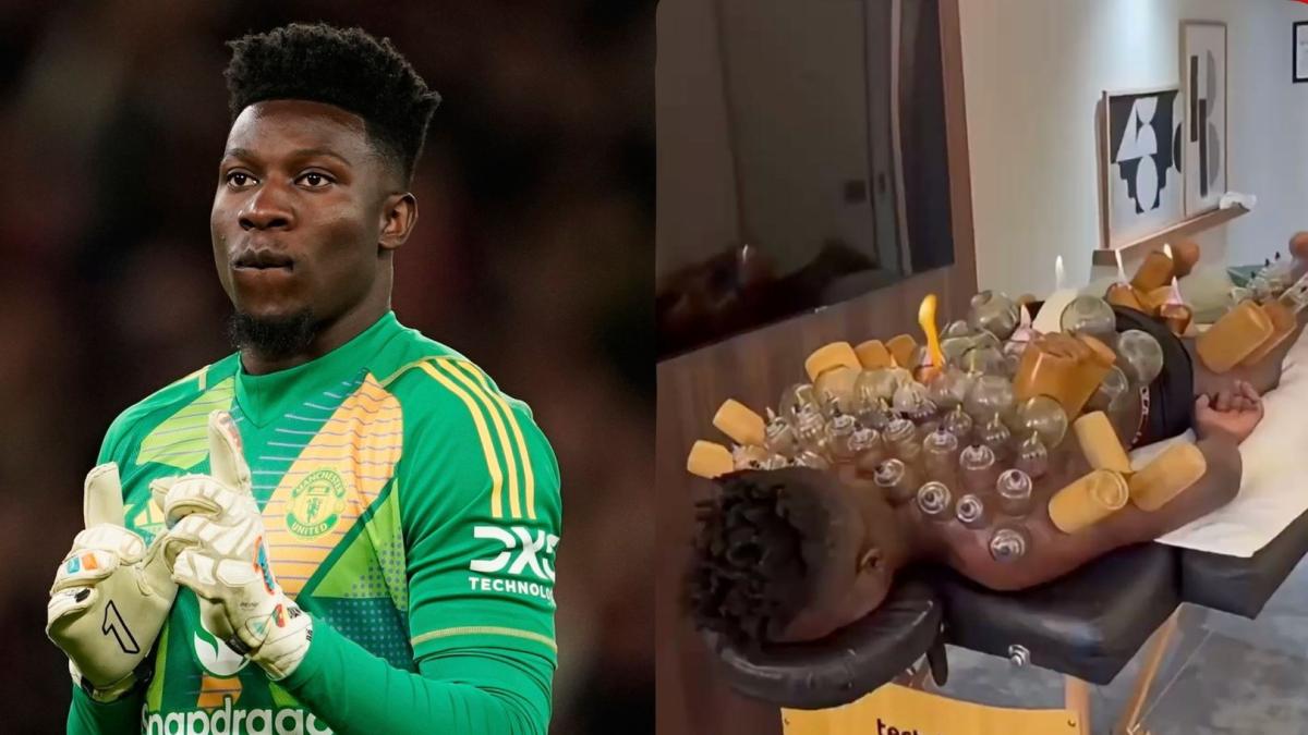 André Onana turns to a bizarre fire-and-cupping therapy to recover after training