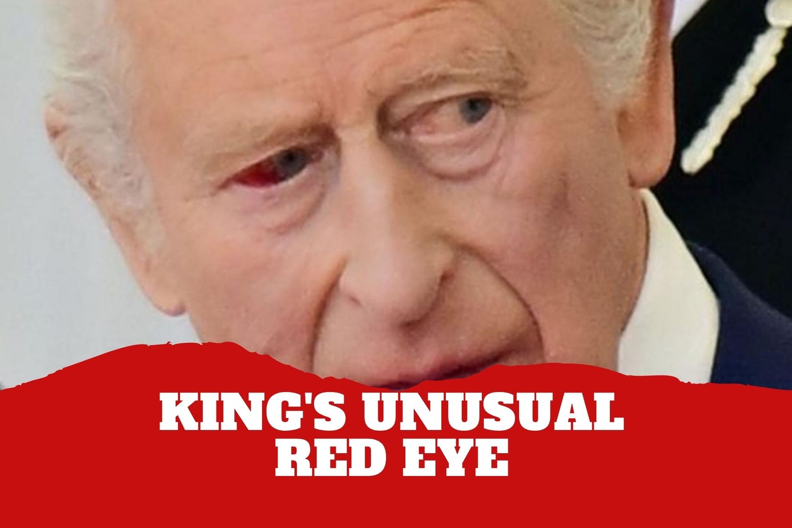 King Charles III appears with unusual red eye sparking questions after apparent burst vessel