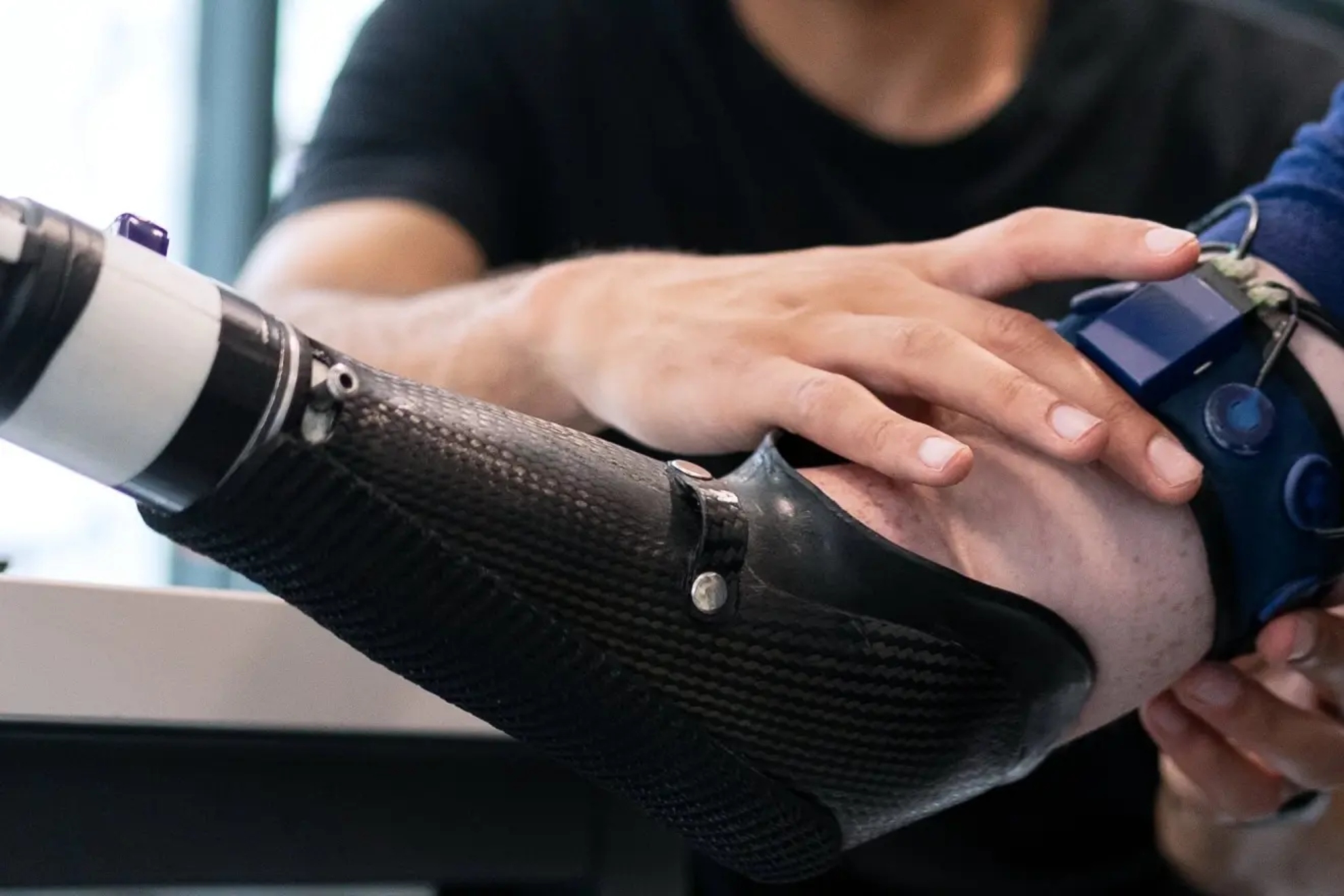 The bionic implants that could change people's lives in Spain | MARCA
