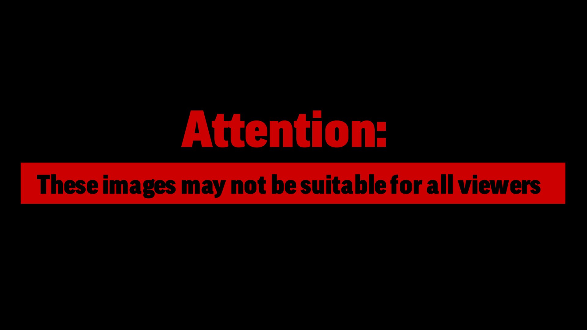 Cameron Smotherman collapses after making weight at UFC 324