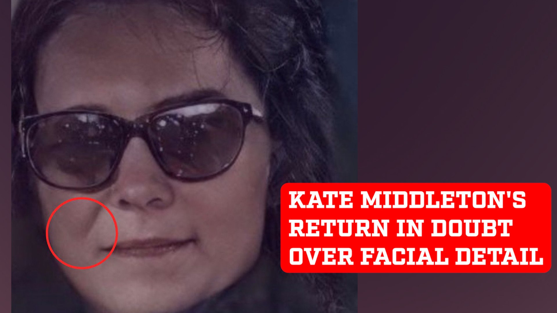 Kate Middleton's public reappearance in doubt by fans over facial detail