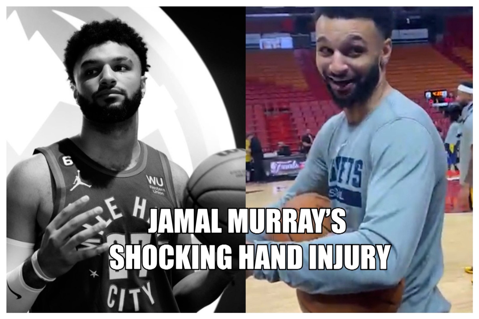 The enormous wound that Jamal Murray suffered on his hand during NBA Game 3