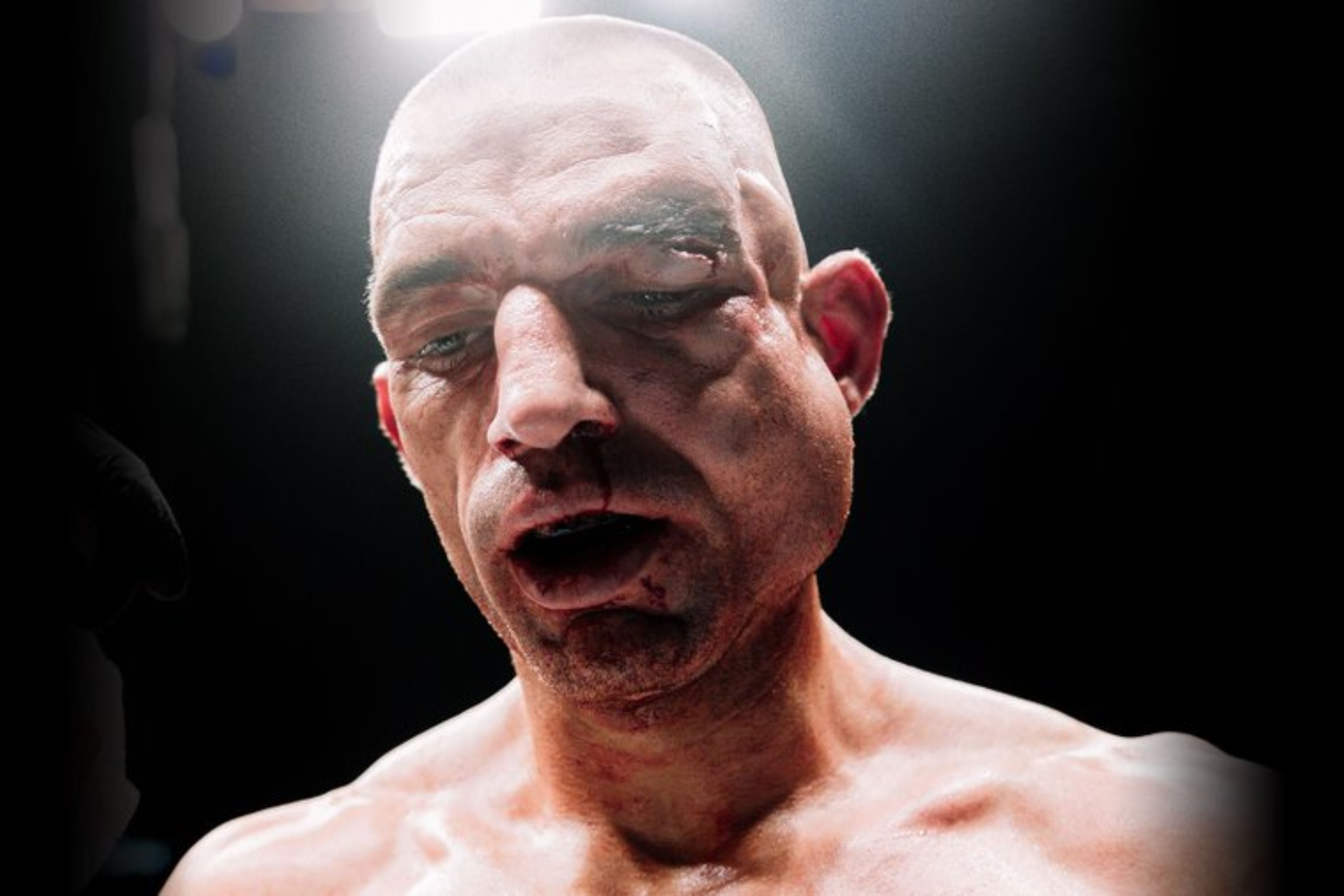 Ste Wallwork underwent an impressive transformation during his BKFC debut, and the doctor made a decision before the third round could begin. instagram@bareknucklefc