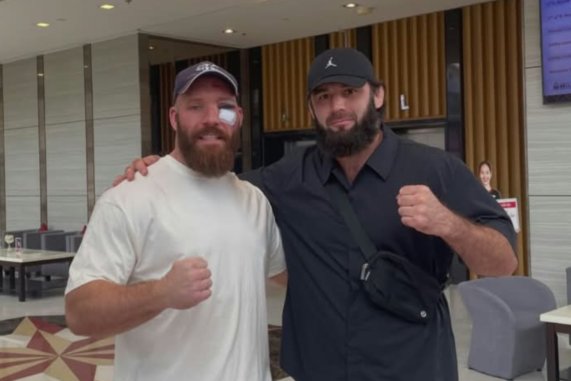 The Briton lost to the undefeated Shamil Erdogan in the second round of ONE Fight Night 48 and later showed the injuries the fight left him with. instagram@paul.elliottmma