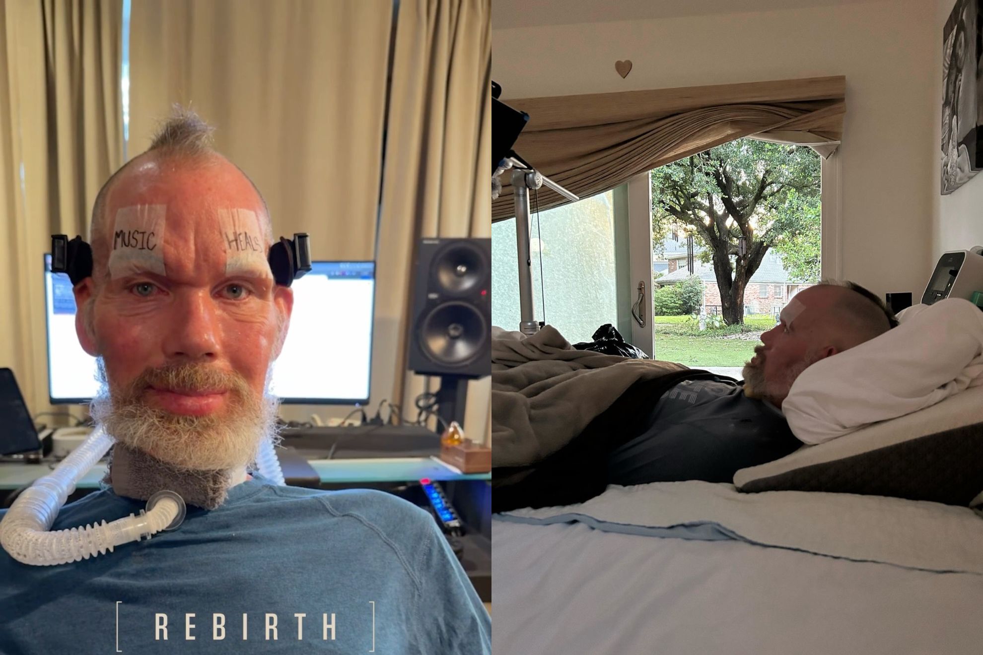 Steve Gleason